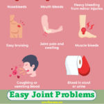 Easy Joint Problems