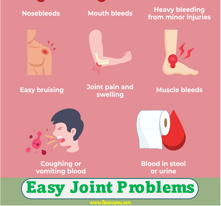 Easy Joint Problems